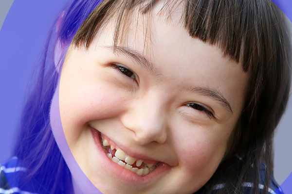 Entenda como a Fisioterapia ajuda no desenvolvimento motor da criança com Síndrome de Down