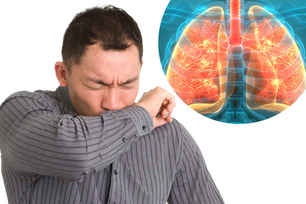 Dia Nacional de Combate à Tuberculose: conheça as formas de prevenção e tratamento 